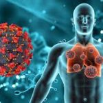 Menos contagios de neumonía